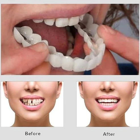 2PC Adjustable Snap On Smile Veneers Teeth For Men And Women
