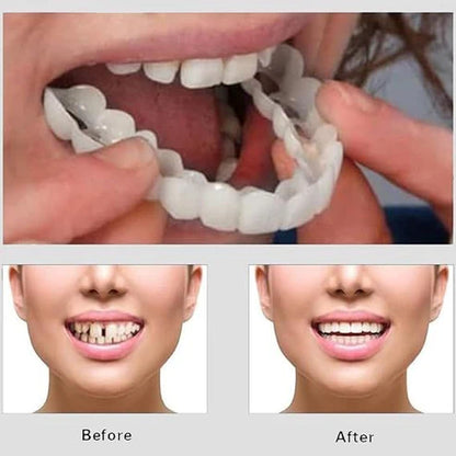 2PC Adjustable Snap On Smile Veneers Teeth For Men And Women